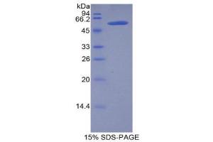 SDS-PAGE (SDS) image for Lipase, Hepatic (LIPC) (AA 159-415) protein (His tag,GST tag) (ABIN2123166)