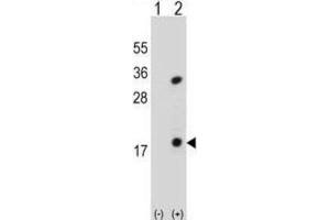 Western Blotting (WB) image for anti-Phospholipase A2, Group IB (PLA2G1B) antibody (ABIN3002154) (PLA2G1B antibody)