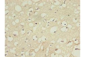 Immunohistochemistry of paraffin-embedded human brain tissue using ABIN7156983 at dilution of 1:100 (RABL4 antibody  (AA 1-186))