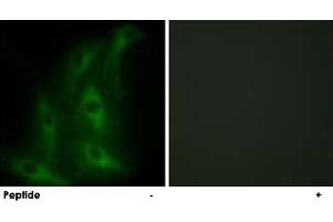 Immunofluorescence analysis of HeLa cells, using COL4A6 polyclonal antibody . (COL4a6 antibody)