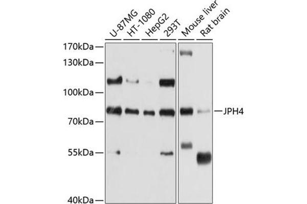 Junctophilin 4 antibody  (AA 405-605)
