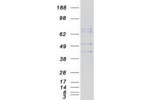 Western Blotting (WB) image for Melatonin Receptor 1A (MTNR1A) protein (Myc-DYKDDDDK Tag) (ABIN2726541)