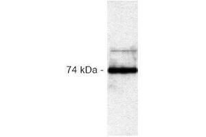 Western Blotting (WB) image for anti-V-Raf-1 Murine Leukemia Viral Oncogene Homolog 1 (RAF1) antibody (ABIN126882) (RAF1 antibody)