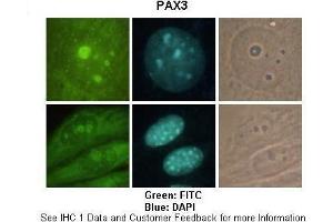 Sample Type :  Mouse B16F10  Primary Antibody Dilution :   1:200  Secondary Antibody :  Goat anti-rabbit-FITC  Secondary Antibody Dilution :   1:800  Color/Signal Descriptions :  Green: FITC Blue: DAPI  Gene Name :  PAX3  Submitted by :  Tsu Fang Wu, Institute of Molecular Biology, National Chung Hsing University (Paired Box 3 antibody  (C-Term))