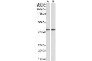 AP23750PU-N GNAQ antibody staining of Mouse (A) and Rat (B) Testis lysate at 0. (GNAQ antibody  (Internal Region))