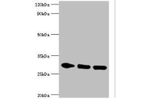 Western blot All lanes: PRKAB2 antibody at 5 μg/mL Lane 1: Rat brain tissue Lane 2: Mouse heart tissue Lane 3: Mouse gonad tissue Secondary Goat polyclonal to rabbit IgG at 1/10000 dilution Predicted band size: 31, 22 kDa Observed band size: 31 kDa