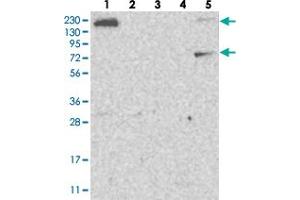 Western blot analysis of Lane 1: RT-4, Lane 2: U-251 MG, Lane 3: Human Plasma, Lane 4: Liver, Lane 5: Tonsil with FAM83H polyclonal antibody  at 1:250-1:500 dilution. (FAM83H antibody)
