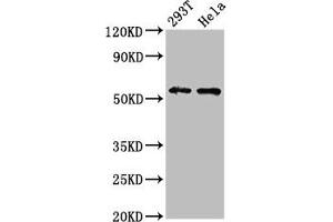 Western Blot Positive WB detected in: 293T whole cell lysate, Hela whole cell lysate All lanes: EPOR antibody at 4.