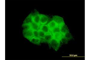 Immunofluorescence of monoclonal antibody to DVL3 on A-431 cell. (DVL3 antibody  (AA 1-100))
