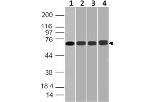 Image no. 1 for anti-DEAD (Asp-Glu-Ala-Asp) Box Polypeptide 3, X-Linked (DDX3X) (AA 10-230) antibody (ABIN5027139) (DDX3X antibody  (AA 10-230))