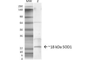 Western blot analysis of Mouse Lung showing detection of ~18 kDa SOD1 (EDI) protein using Rabbit Anti-SOD1 (EDI) Polyclonal Antibody . (SOD1 antibody  (C-Term) (PerCP))