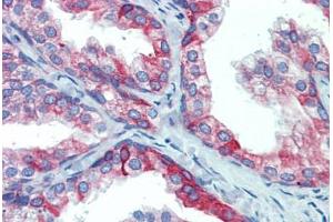 Prostate, Human: Formalin-Fixed, Paraffin-Embedded (FFPE) (PDIA4 antibody  (AA 623-638))