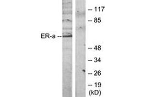 Western blot analysis of extracts from MCF7 cells, treated with Estradiol, using Estrogen Receptor-alpha (Ab-118) Antibody. (Estrogen Receptor alpha antibody  (AA 91-140))