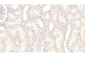 Detection of PAI1 in Human Kidney Tissue using Monoclonal Antibody to Plasminogen Activator Inhibitor 1 (PAI1) (PAI1 antibody)