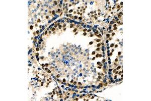 Immunohistochemistry of paraffin embedded rat testis using RNF7 (ABIN7075471) at dilution of 1:1000 (400x lens)