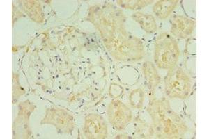 Immunohistochemistry of paraffin-embedded human kidney tissue using ABIN7170959 at dilution of 1:100 (SULT1C2 antibody  (AA 1-120))