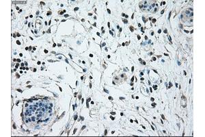 Immunohistochemical staining of paraffin-embedded breast tissue using anti-NRBP1 mouse monoclonal antibody. (NRBP1 antibody)