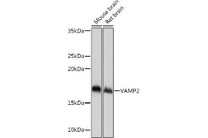 Western blot analysis of extracts of various cell lines, using V Rabbit mAb (ABIN7271313) at 1:1000 dilution. (VAMP2 antibody)