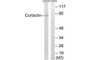Western blot analysis of extracts from LOVO cells, using Cortactin (Ab-466) Antibody.