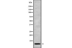Western blot analysis NDUFC1 using Jurkat whole cell lysates (NDUFC1 antibody  (C-Term))