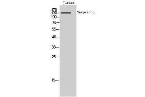 Western Blotting (WB) image for anti-Chromosome 14 Open Reading Frame 49 (C14orf49) (Internal Region) antibody (ABIN3185823) (Nesprin3 antibody  (Internal Region))