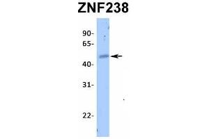 Host:  Rabbit  Target Name:  ZNF238  Sample Type:  Human Fetal Heart  Antibody Dilution:  1. (ZNF238 antibody  (N-Term))
