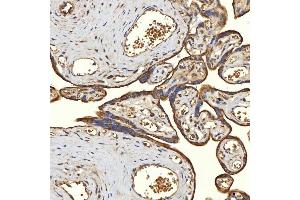 IHC analysis of TST using anti-TST antibody (ABIN7599105).