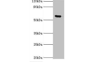 Western blot All lanes: MKS1 antibody at 6 μg/mL + Hela whole cell lysate Secondary Goat polyclonal to rabbit IgG at 1/10000 dilution Predicted band size: 65, 60, 64 kDa Observed band size: 65 kDa (MKS1 antibody  (AA 150-300))