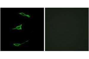 Immunofluorescence analysis of LOVO cells, using FFAR1 Antibody.
