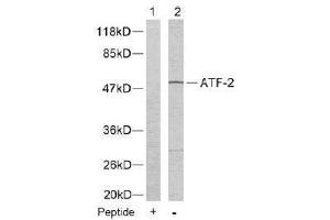 Image no. 2 for anti-Activating Transcription Factor 2 (ATF2) (Thr55), (Thr73) antibody (ABIN197151) (ATF2 antibody  (Thr55, Thr73))