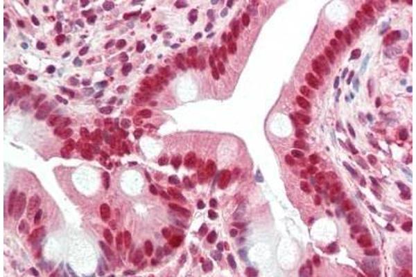 GHDC antibody  (N-Term)