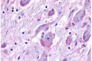 Immunohistochemical staining of human brain with CELSR1 polyclonal antibody . (CELSR1 antibody  (N-Term))