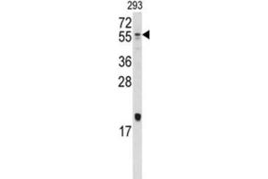 Western Blotting (WB) image for anti-Bone Morphogenetic Protein 10 (BMP10) antibody (ABIN5018806)