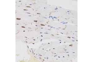 Immunohistochemistry of paraffin-embedded rat heart using FAF1 antibody (ABIN5975642) (40x lens). (FAF1 antibody)
