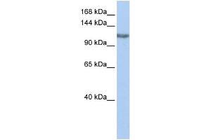 WB Suggested Anti-TGS1 Antibody Titration:  0. (TGS1 antibody  (Middle Region))