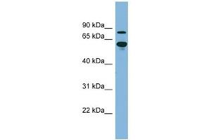 ABCF2 antibody used at 1 ug/ml to detect target protein. (ABCF2 antibody)