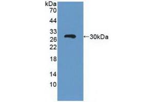 Figure. (ABCC3 antibody  (AA 1291-1523))