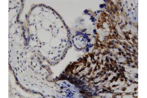 Immunoperoxidase of monoclonal antibody to LIMA1 on formalin-fixed paraffin-embedded human placenta. (LIMA1 antibody  (AA 1-598))