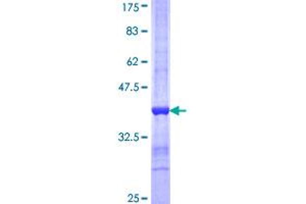 PROS1 Protein (AA 419-516) (GST tag)