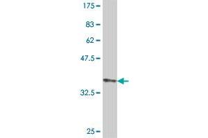 Western Blot detection against Immunogen (38. (MYH7 antibody  (AA 1-109))