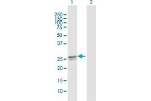 Western Blot analysis of C17orf66 expression in transfected 293T cell line by C17orf66 MaxPab polyclonal antibody. (C17orf66 antibody  (AA 1-219))