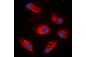 Immunofluorescent analysis of S6K1 (pS434) staining in K562 cells. (RPS6KB1 antibody  (C-Term, pSer434))