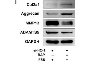 Rapamycin regulates autophagy and ECM in NP cells. (COL2A1 antibody  (AA 873-1072))