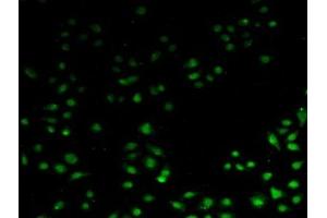 Detection of API5 in Human Hela Cells using Polyclonal Antibody to Apoptosis Inhibitor 5 (API5) (Apoptosis Inhibitor 5 antibody  (AA 2-360))
