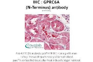 Image no. 1 for anti-G Protein-Coupled Receptor, Family C, Group 6, Member A (GPRC6A) (Extracellular Domain), (N-Term) antibody (ABIN1735226) (GPRC6A antibody  (Extracellular Domain, N-Term))