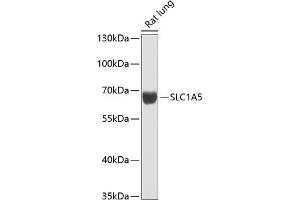 Western blot analysis of extracts of rat lung, using SLC1 antibody (ABIN6128765, ABIN6147874, ABIN6147876 and ABIN6216404) at 1:1000 dilution. (SLC1A5 antibody  (AA 1-100))