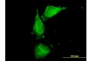 Immunofluorescence of purified MaxPab antibody to UMOD on HeLa cell.
