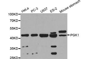 Western blot analysis of extracts of various cell lines, using PGK1 antibody (ABIN5971017) at 1/1000 dilution. (PGK1 antibody)