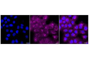 Immunocytochemical staining of HT- cells with NEK6 antibody (ABIN7799603), 1:1,000).