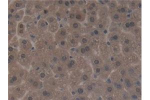 Detection of SIRT3 in Mouse Liver Tissue using Polyclonal Antibody to Sirtuin 3 (SIRT3) (SIRT3 antibody  (AA 5-257))